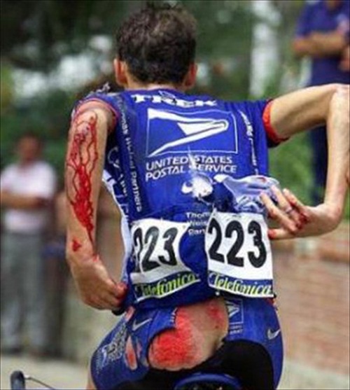 Painful Wipeout Picture